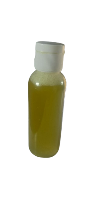 GLAUCOME CATARACTE VISION FLOUE